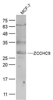 ZCCHC9 Rabbit Polyclonal Antibody