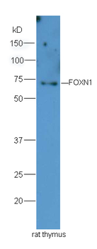 FOXN1 Rabbit Polyclonal Antibody