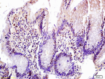 FOXN1 Rabbit Polyclonal Antibody