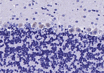 Neurotrophin 3 Rabbit Polyclonal Antibody