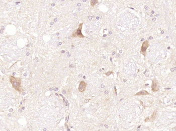 Phospho-Tau (Thr181) Rabbit Polyclonal Antibody