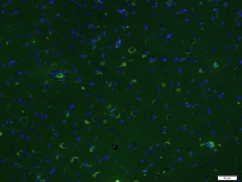GW182 Rabbit Polyclonal Antibody (FITC)