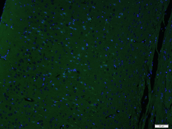 GW182 Rabbit Polyclonal Antibody (FITC)