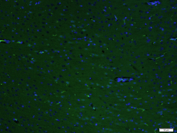 GW182 Rabbit Polyclonal Antibody (FITC)