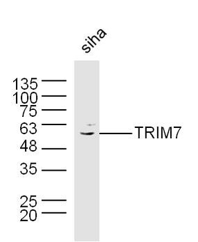 TRIM7 Rabbit Polyclonal Antibody