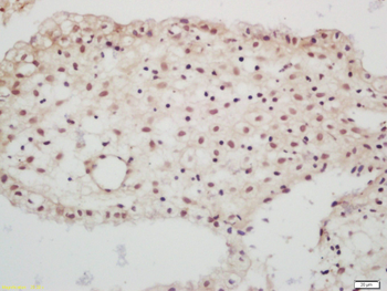 RING2 Rabbit Polyclonal Antibody