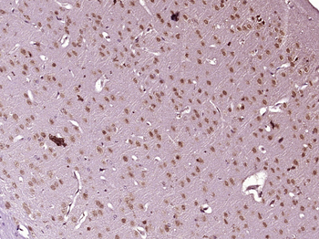 RNF8 Rabbit Polyclonal Antibody