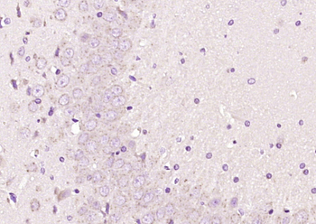 RNF22/TRIM3 Rabbit Polyclonal Antibody