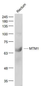 MTM1 Rabbit Polyclonal Antibody