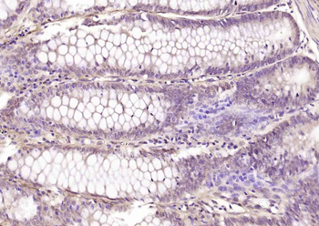 MLF1/MLF2 Rabbit Polyclonal Antibody