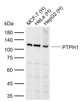 PTPH1 Rabbit Polyclonal Antibody