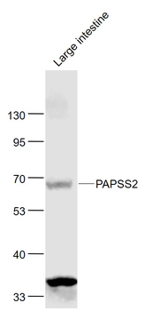 PAPSS2 Rabbit Polyclonal Antibody