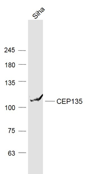 PDZD6 Rabbit Polyclonal Antibody