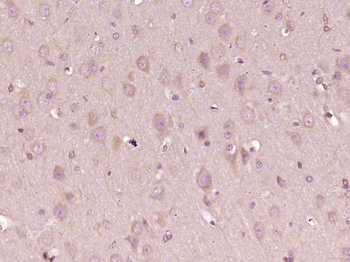 PDZD8 Rabbit Polyclonal Antibody