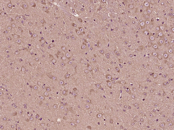 TRPM3 Rabbit Polyclonal Antibody
