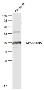MMAA/cblA Rabbit Polyclonal Antibody