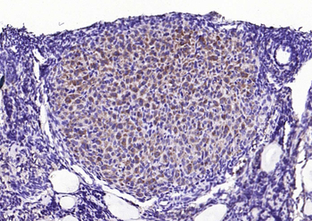 Phospho-STMN1 (Ser63) Rabbit Polyclonal Antibody