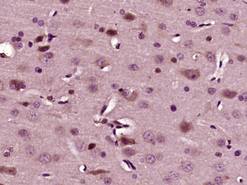 Phospho-STMN1 (Ser63) Rabbit Polyclonal Antibody