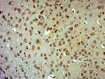 C8orf70 Rabbit Polyclonal Antibody