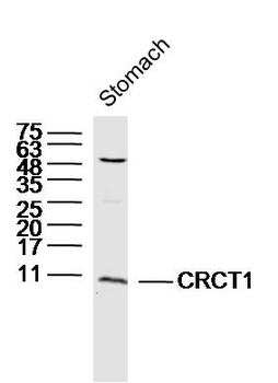CRCT1 Rabbit Polyclonal Antibody