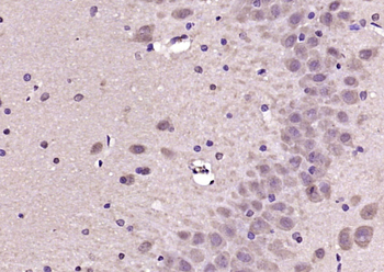 CREG2 Rabbit Polyclonal Antibody