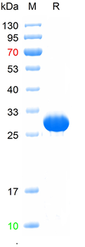 Recombinant human MCU protein, N-Trx-His