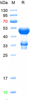 Recombinant human MYH1 protein, N-His