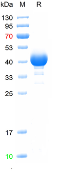 Recombinant human GIMAP6 protein, N-His