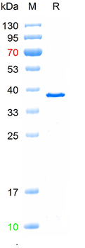 Recombinant human ALPL protein