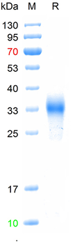 Recombinant human HCG Beta protein, C-His (HEK293)