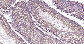 HSC70 Ready-To-Use IHC Kit