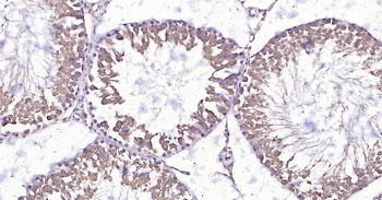 HSC70 Ready-To-Use IHC Kit