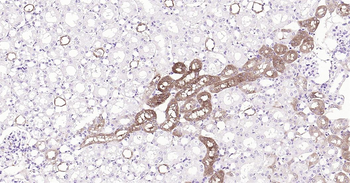Mouse ALDH1A1 Ready-To-Use IHC Kit