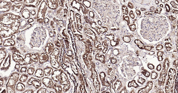 Human SYVN1 Ready-To-Use IHC Kit