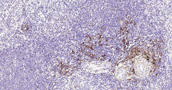 Human HLA-DR Ready-To-Use IHC Kit