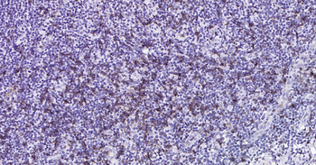 Human CD8 Ready-To-Use IHC Kit