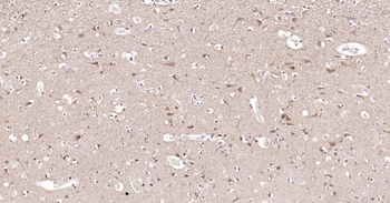 Human STMN1 Ready-To-Use IHC Kit
