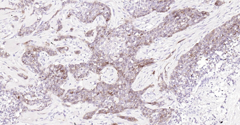 Human STMN1 Ready-To-Use IHC Kit