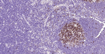 STMN1 Ready-To-Use IHC Kit
