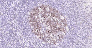 STMN1 Ready-To-Use IHC Kit