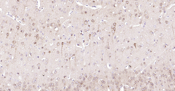 STMN1 Ready-To-Use IHC Kit