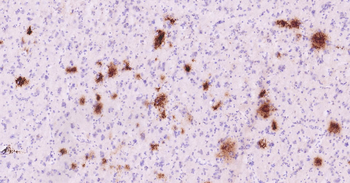 Human beta-Amyloid(1-42) Ready-To-Use IHC Kit