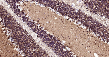 TUBB3 Ready-To-Use IHC Kit