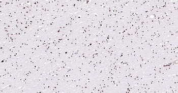 Human BRD7 Ready-To-Use IHC Kit