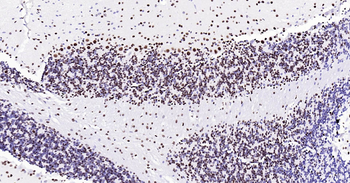 Mouse TARDBP Ready-To-Use IHC Kit