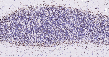 Rat TARDBP Ready-To-Use IHC Kit