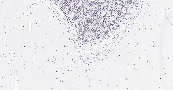 Human TARDBP Ready-To-Use IHC Kit
