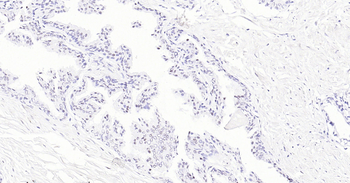 TARDBP Ready-To-Use IHC Kit