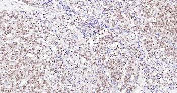 TARDBP Ready-To-Use IHC Kit