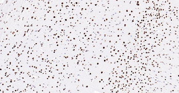 TARDBP Ready-To-Use IHC Kit